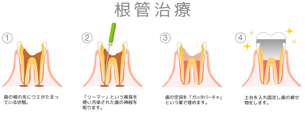 治療の流れ